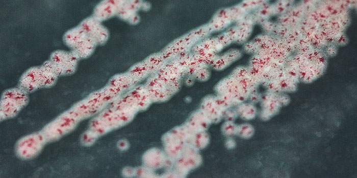 DK: Bifidobacterium longum subspecies infantis. Foto: DTU Fødevareinstituttet | UK: Bifidobacterium longum subspecies infantis. Photo: National Food Institute